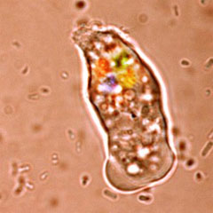 Closeup of the Vista Dysentery.Net-Worm virus